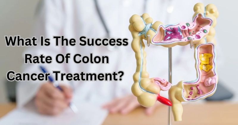 Colon-Cancer