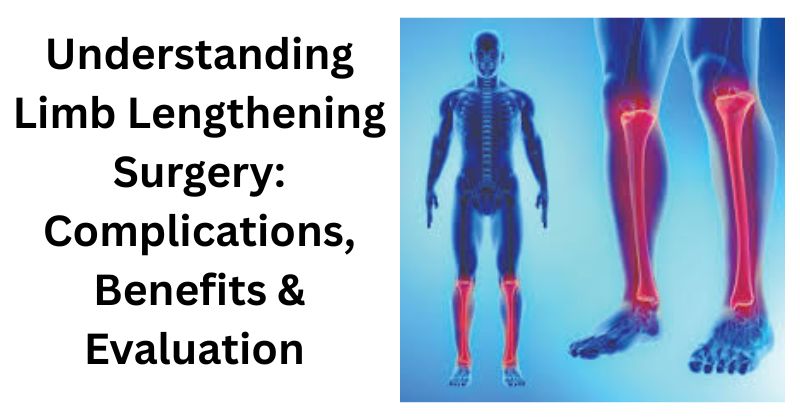Limb Lengthening Surgery