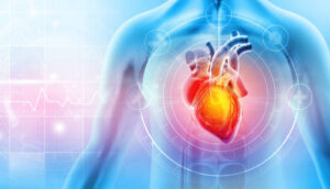 Cardiac Second Opinion