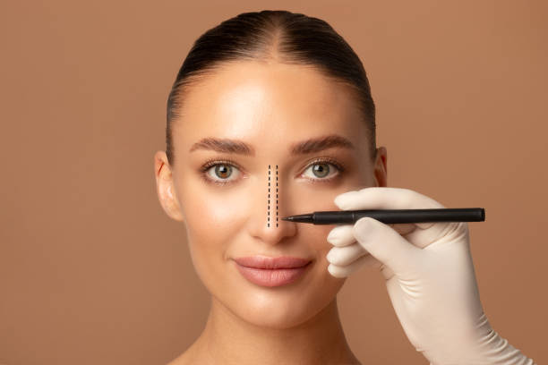 Rhinoplasty in Riyadh