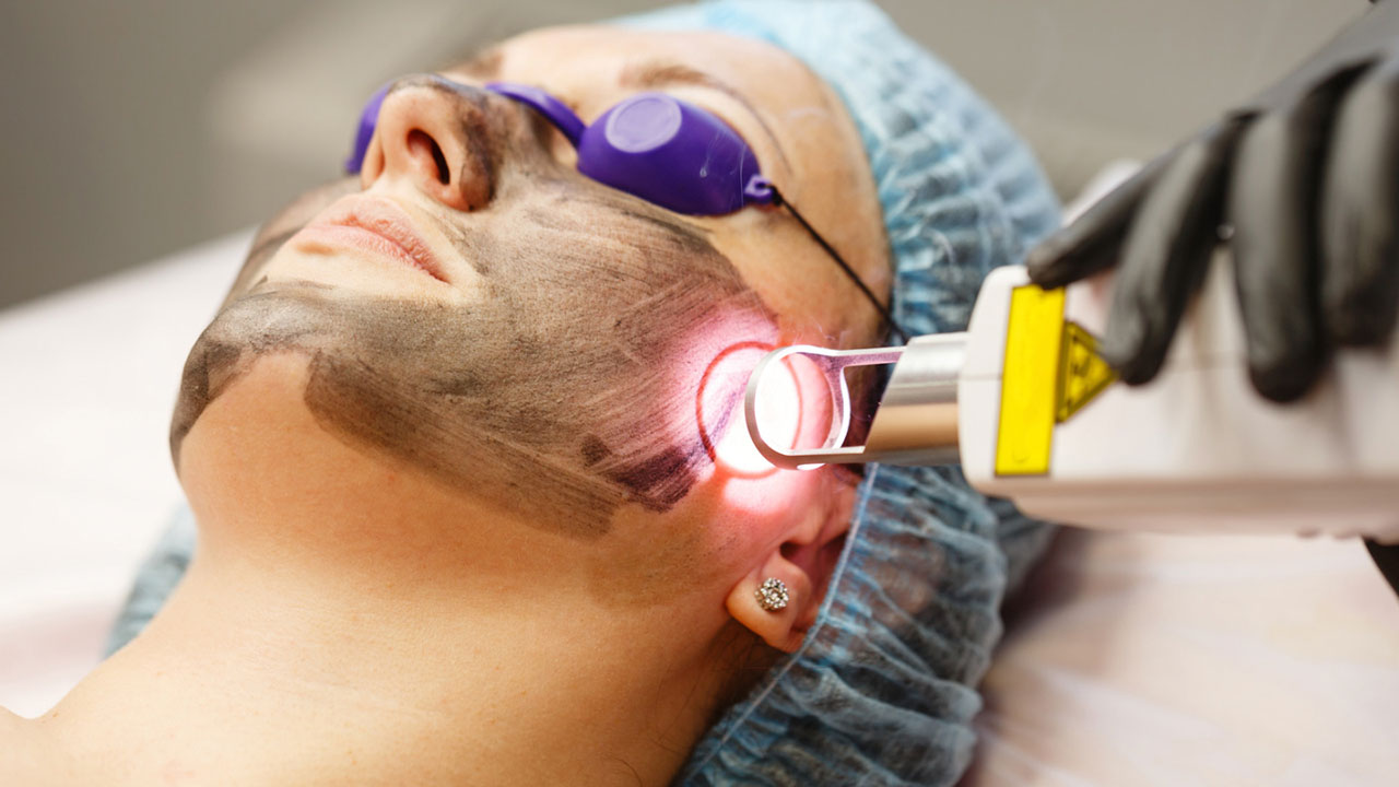 Pico laser treatment ksa