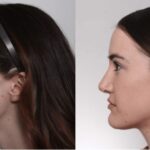 Plastic Surgery/Facial Plastic Surgery