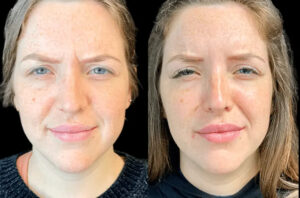 Cost Guide for Botox Treatments in Dubai: What You Need to Know