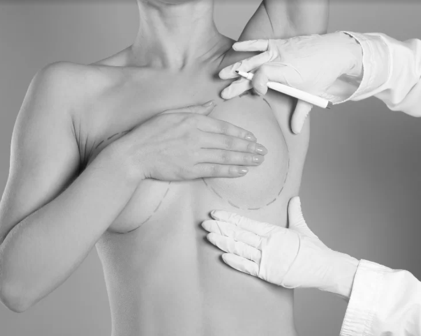 Breast Reduction in Dubai