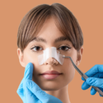 Septoplasty in Dubai
