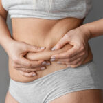 Liposuction in Dubai