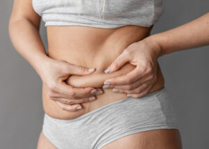 Liposuction in Dubai