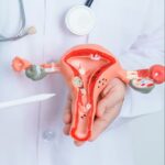 Polycystic Ovary Syndrome Treatment In Dubai
