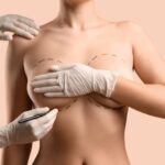 Breast Augmentation in Dubai