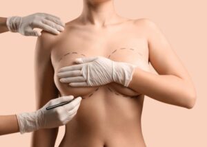 Breast Augmentation in Dubai